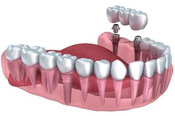 Prosthodontics Welcome Image